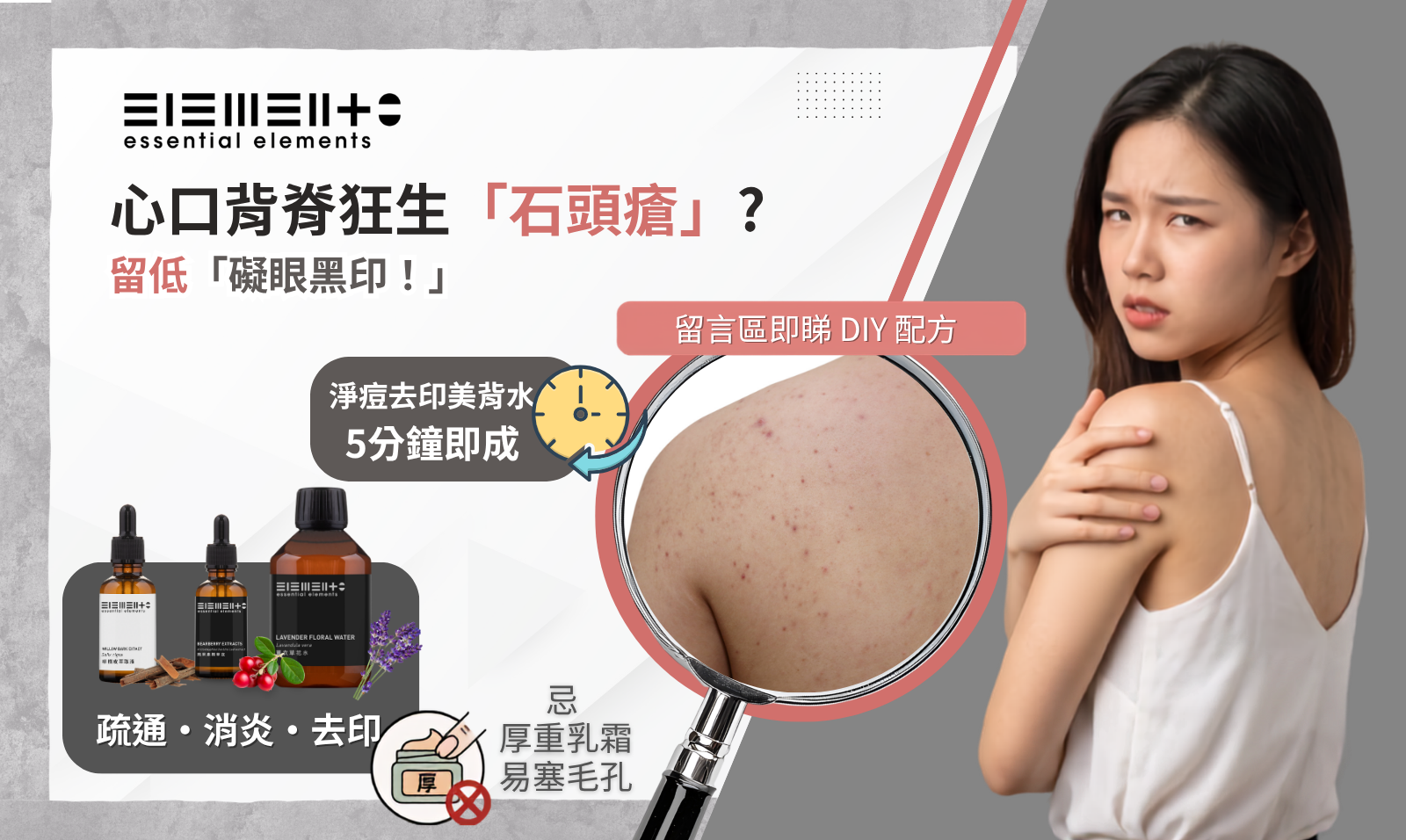 DIY 淨痘去印美背噴霧配方  DIY "Zero-Oil Feel Beautiful Back Water